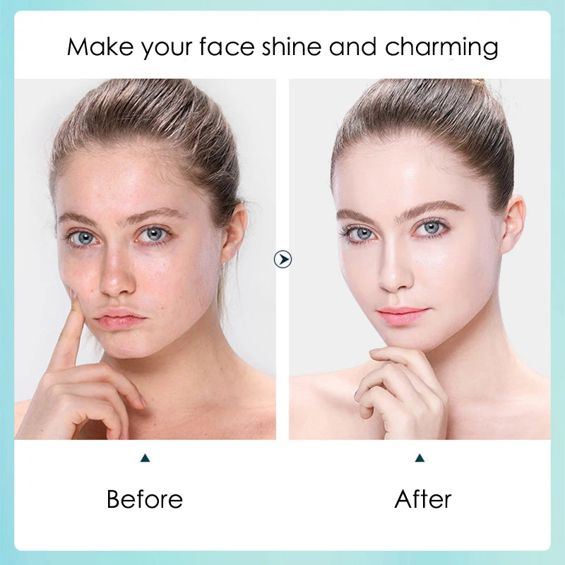 Before & After — Mascarilla Hidratante con Ácido Hialurónico BINGJU